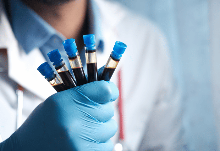 on site pathology